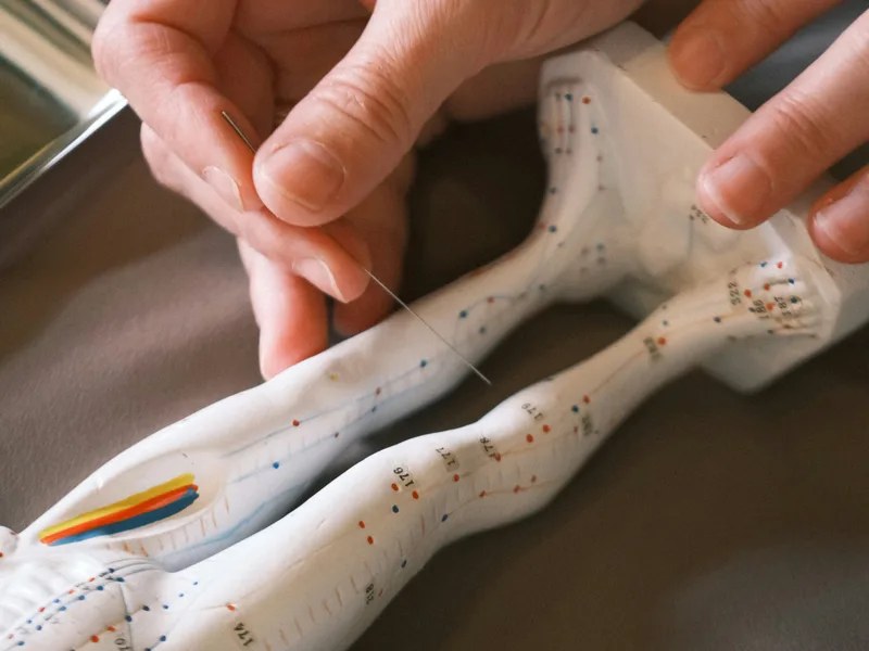 Acupuncture at Alma Sana Chiropractic Studio in Tucson