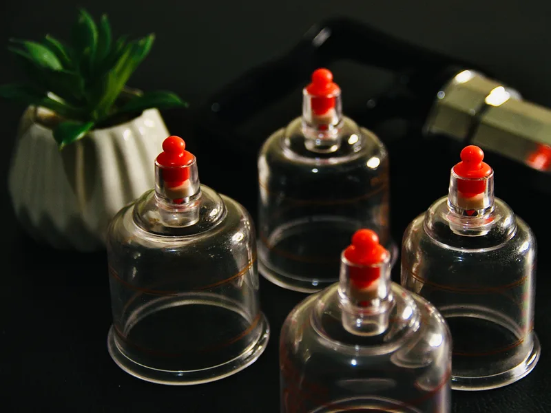 How Cupping Therapy works at Alma Sana Chiropractic Studio