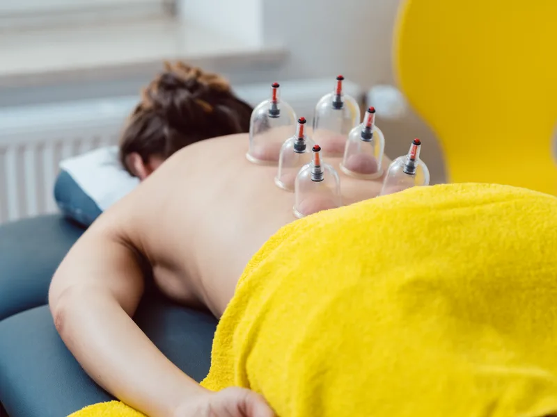 Cupping Therapy at Alma Sana Chiropractic Studio in Tucson