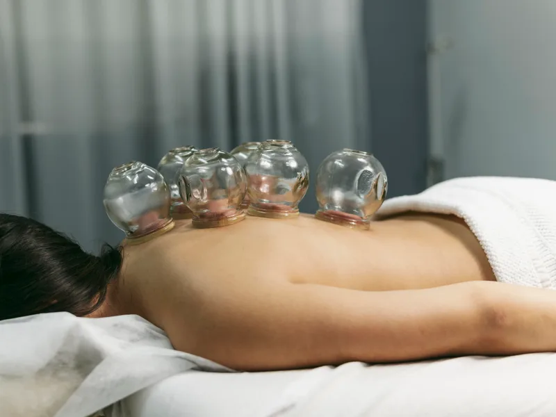 Cupping Therapy at Alma Sana Chiropractic Studio in Tucson