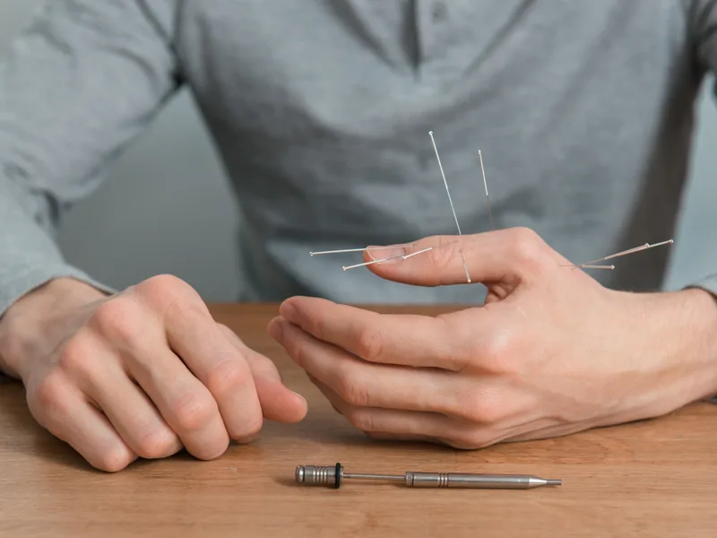 Dry Needling at Alma Sana Chiropractic Studio in Tucson